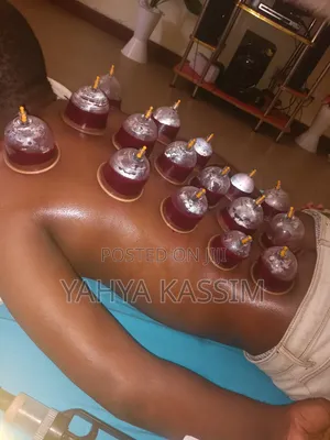 Hijama,(Cupping Therapy)