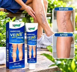 Kleeris Varicose Veins Cream(net Weight 0.61 Oz / 20 G),