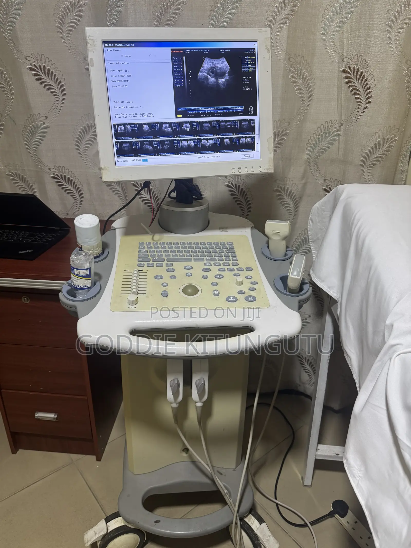 Mashine Ya Ultrasound (Used)
