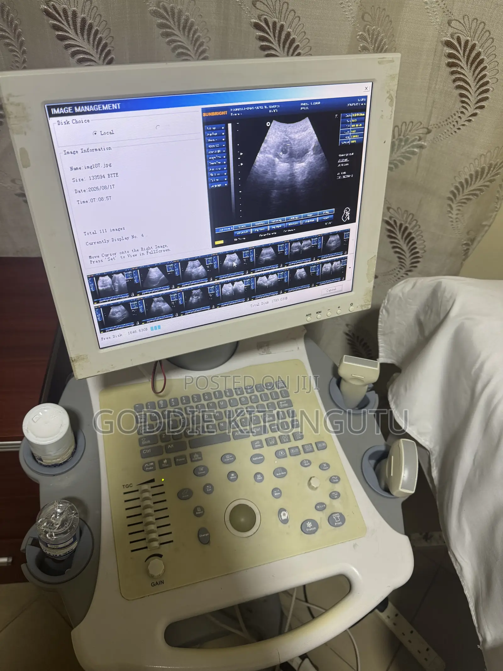 Mashine Ya Ultrasound (Used)