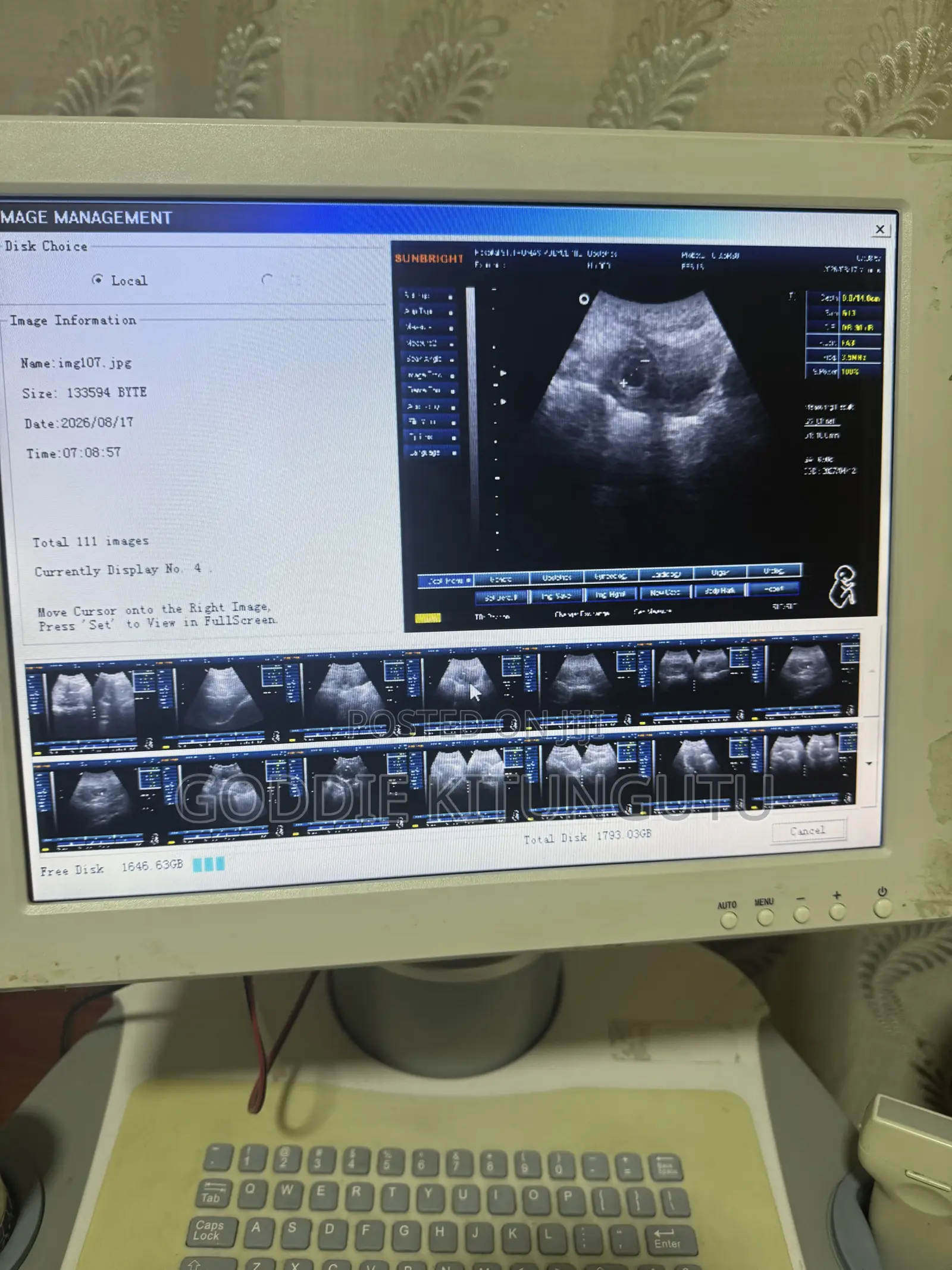 Mashine Ya Ultrasound (Used)