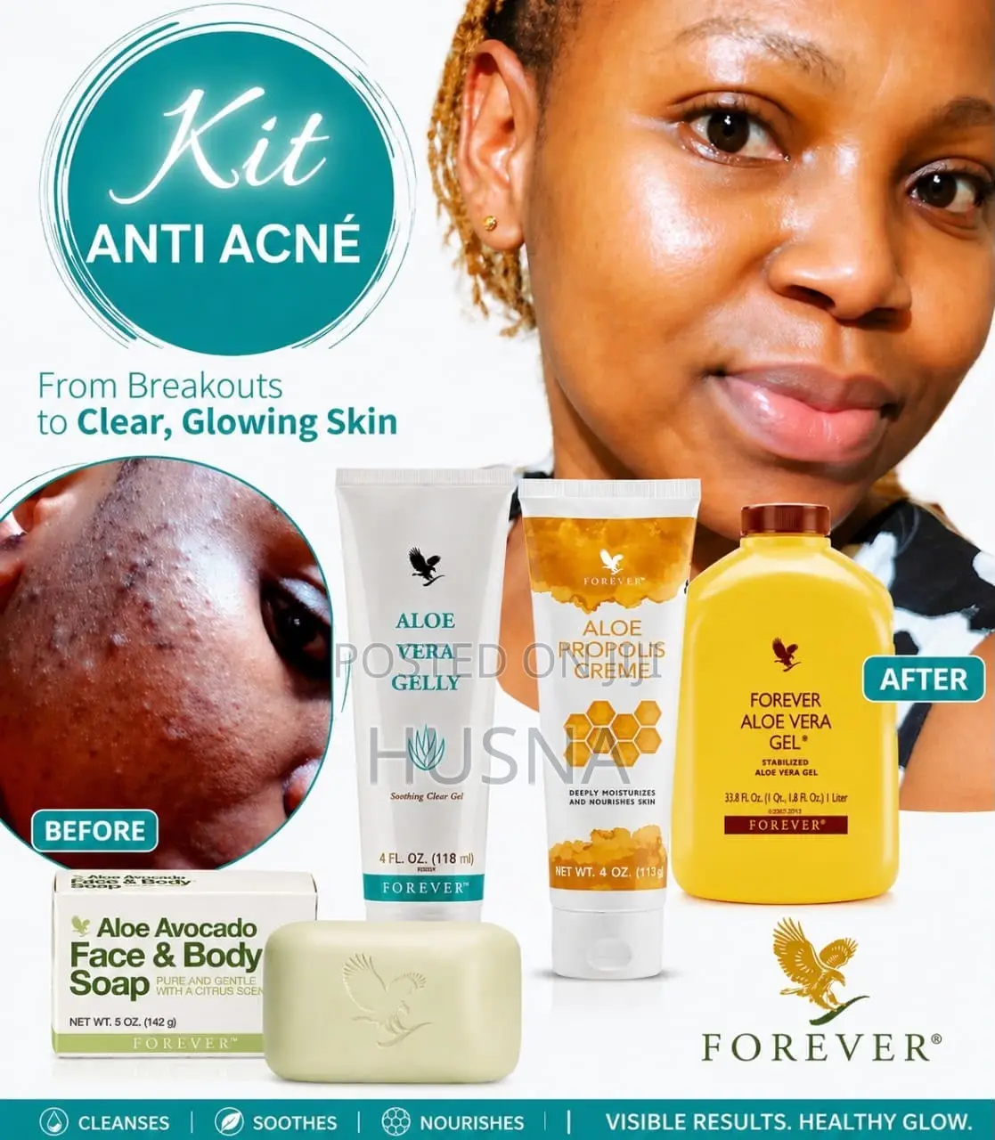 Kit Anti Acne