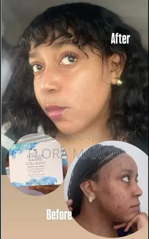 Boresha Afya Ya Ngozi Kutoka Ndani