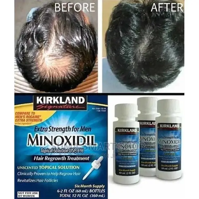MINOXIDIL Kirkland Hair Regrowth.(Otesha Nywele)