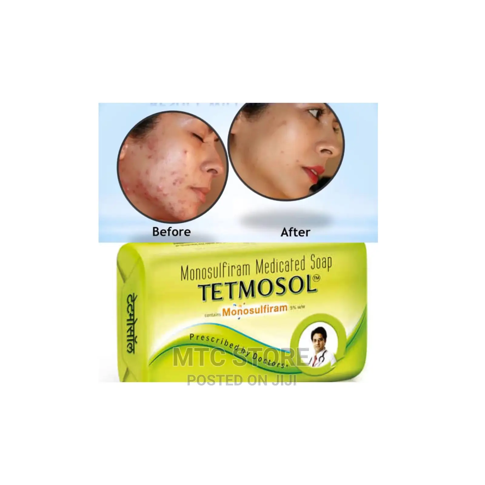 Tetmosol Medicated Soap