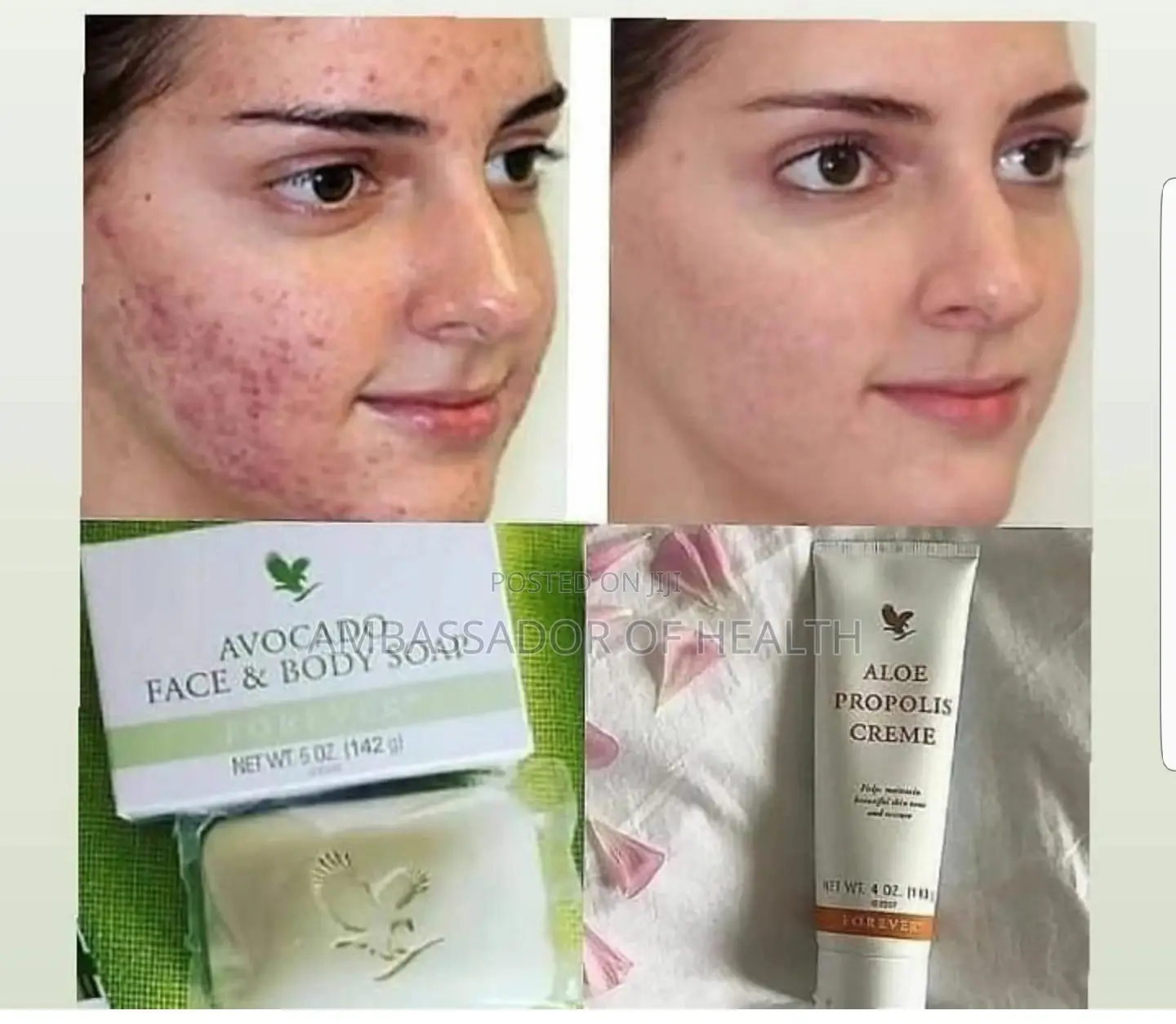 Sabuni Nzuri Kuimarisha Ngozi Iliyoharibik Na Cream Na Jua