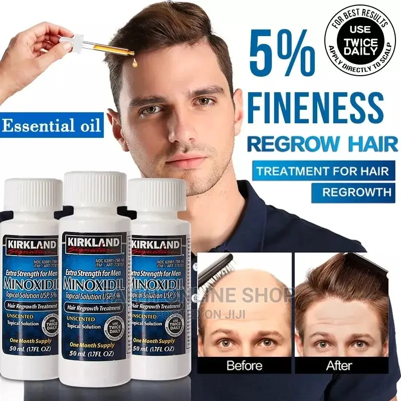 Minoxidil Hair Growth Oil for Men 60mls