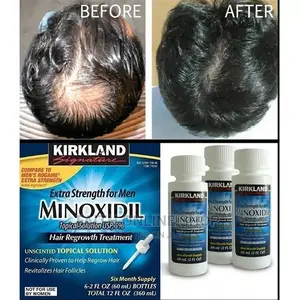 Minoxidil Hair Growth Oil for Men 60mls