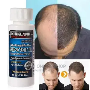 Minoxidil Hair Growth Oil for Men 60mls