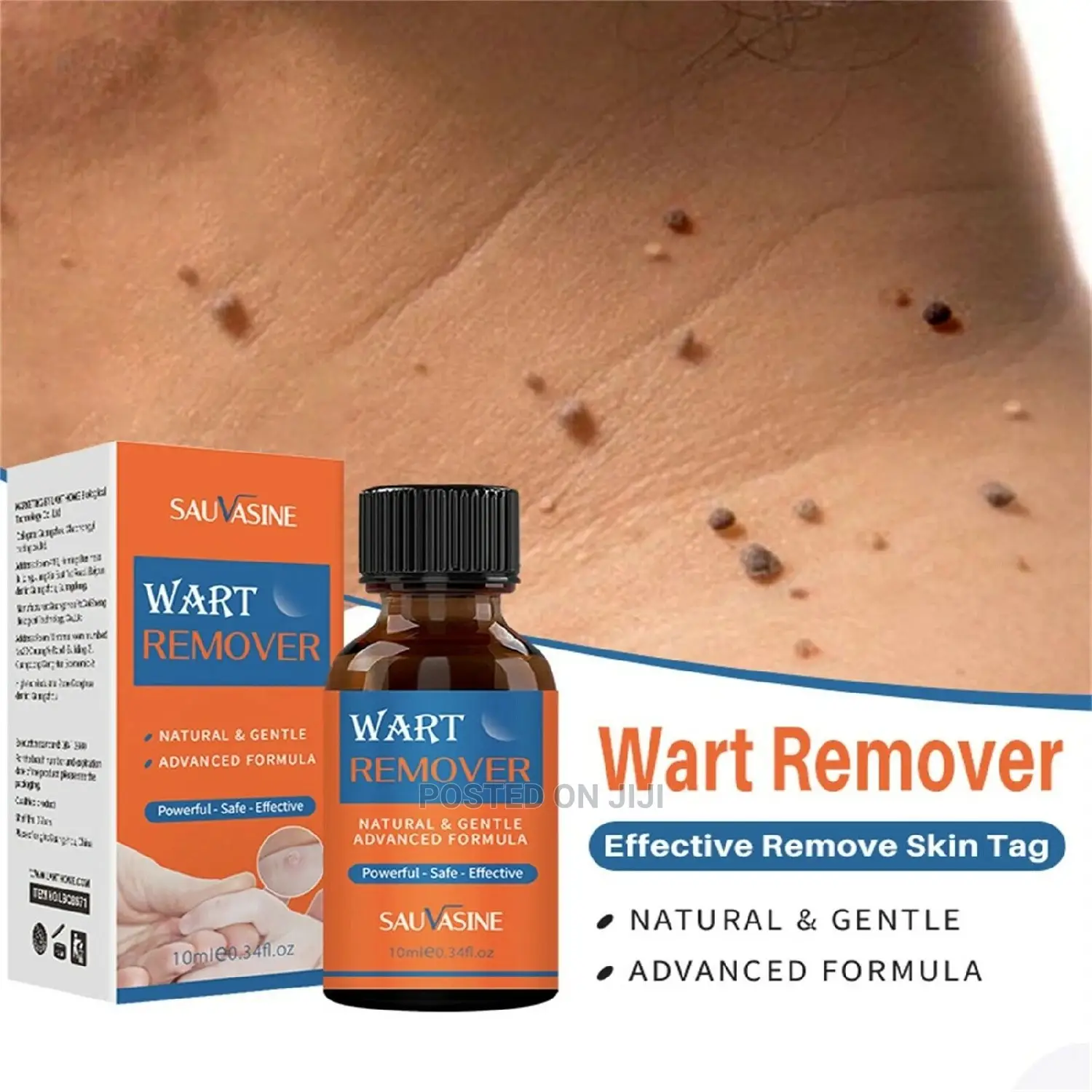 Ondoa Visunzua( Wrat Removal)