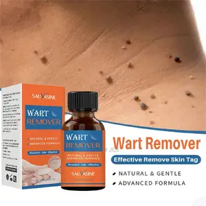 Ondoa Visunzua( Wrat Removal)
