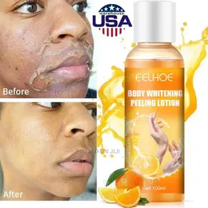Peeling Lotion