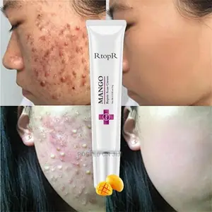 Acne Repear Cream
