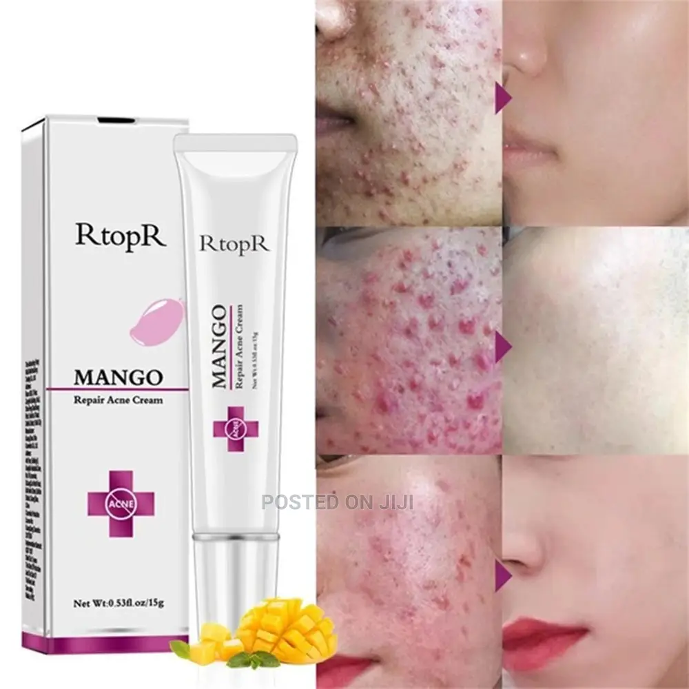 Acne Repear Cream