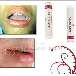 Aloe Lips Kwa Midomo Inayopasuka Pasuka
