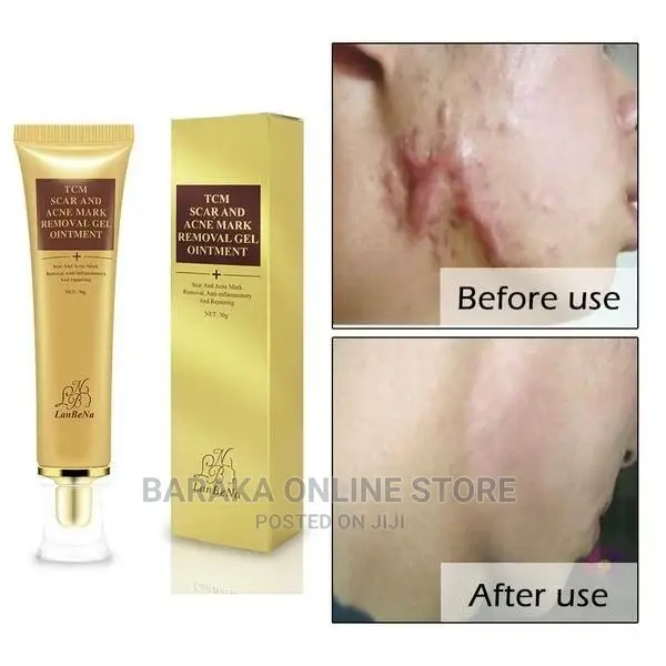 LANBENA Scar Removal Cream