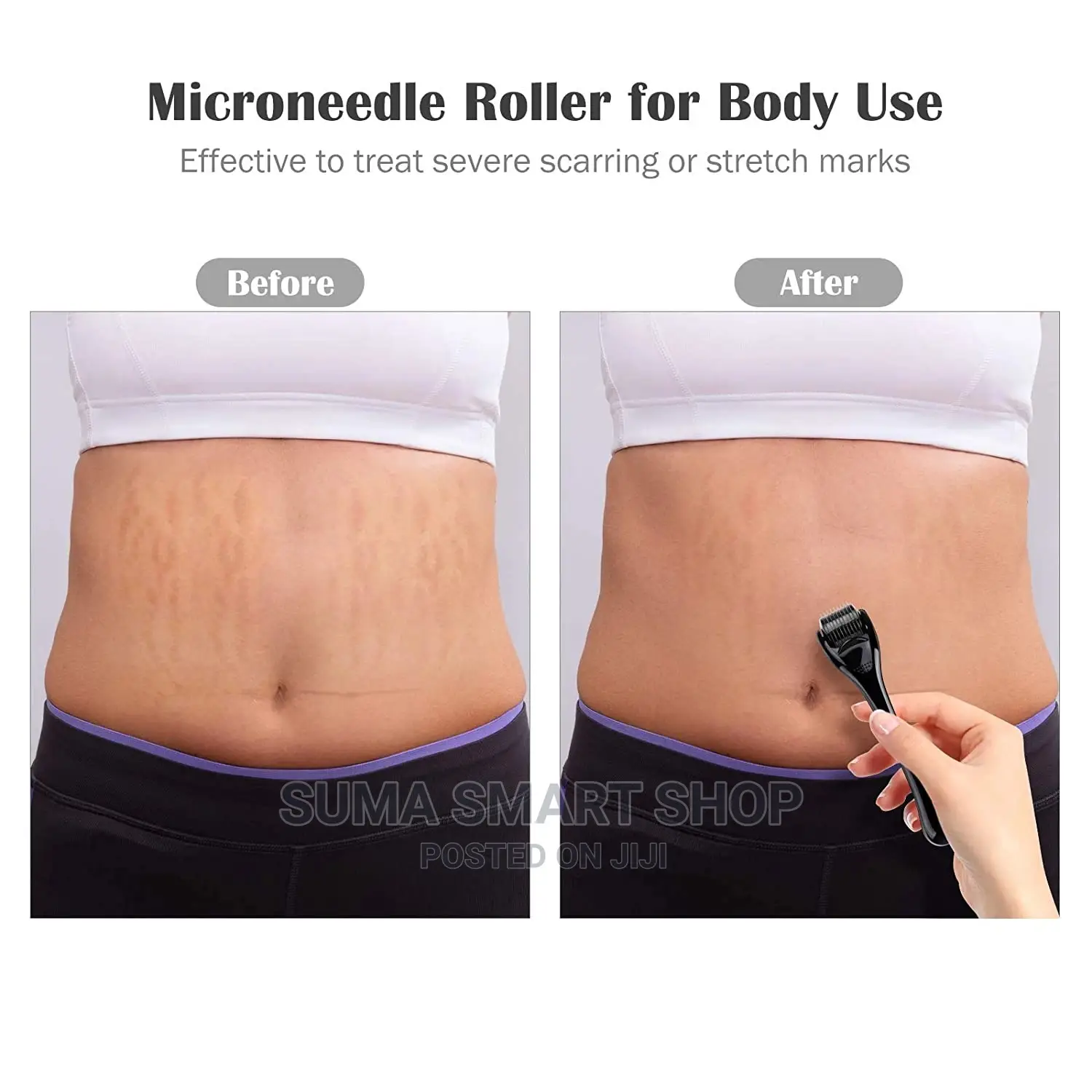 Derma Roller System.(Kifaa Cha Urembo) .