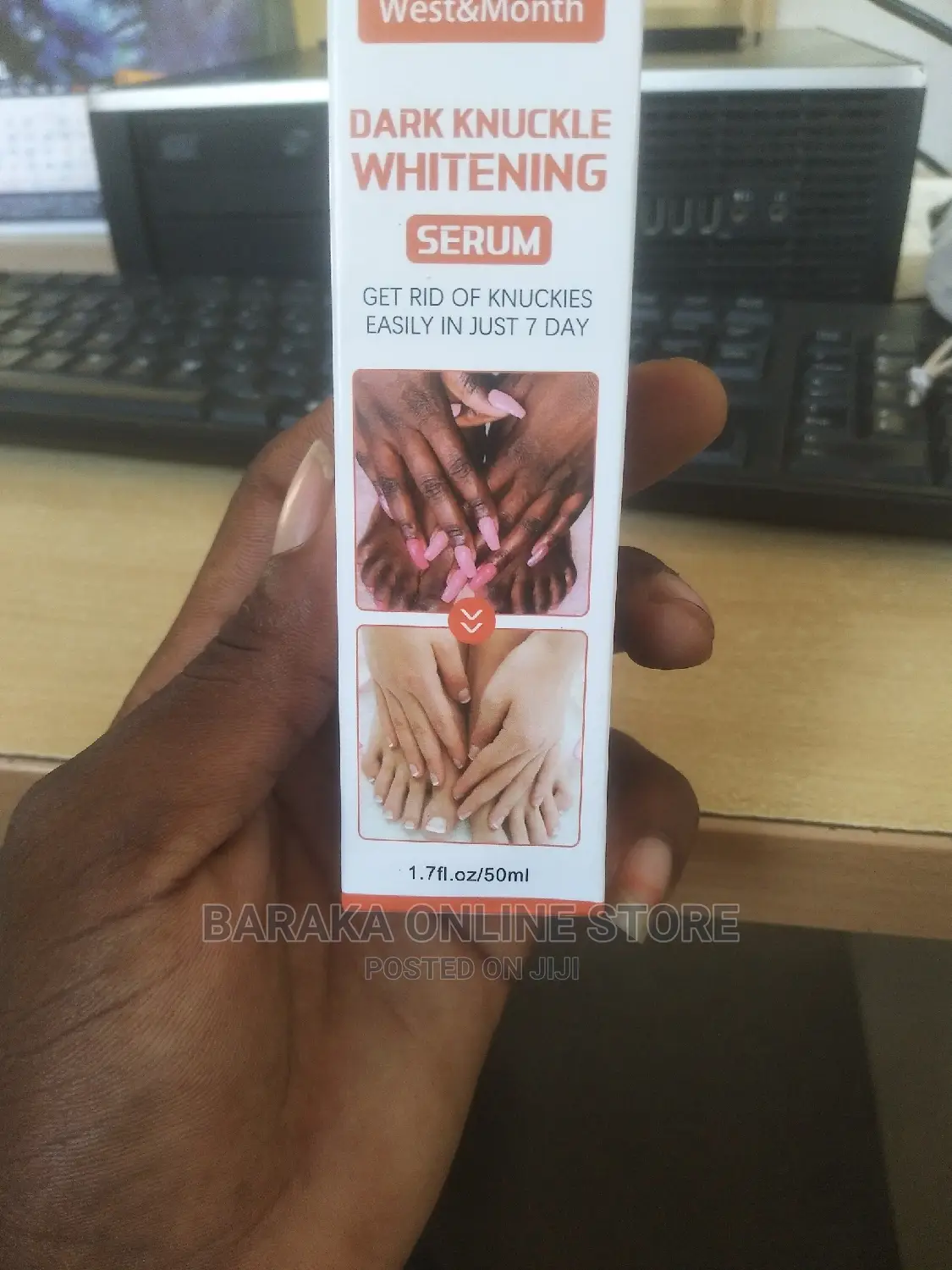 Durk Knuckle Whitening