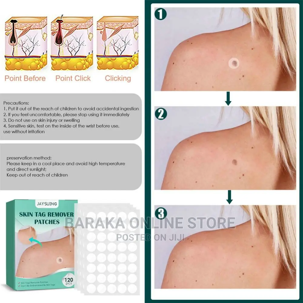 Skin Tag Remover Patch