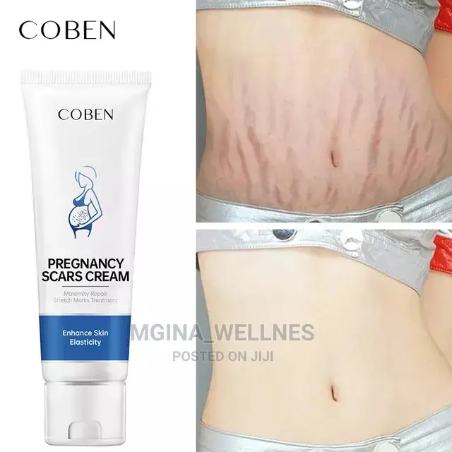 Coben Pregnancy Scars Cream