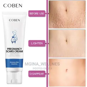 Coben Pregnancy Scars Cream