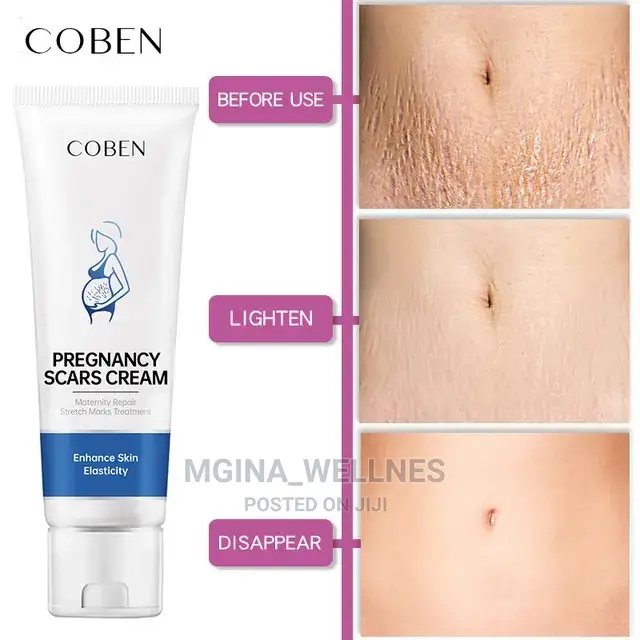Coben Pregnancy Scars Cream