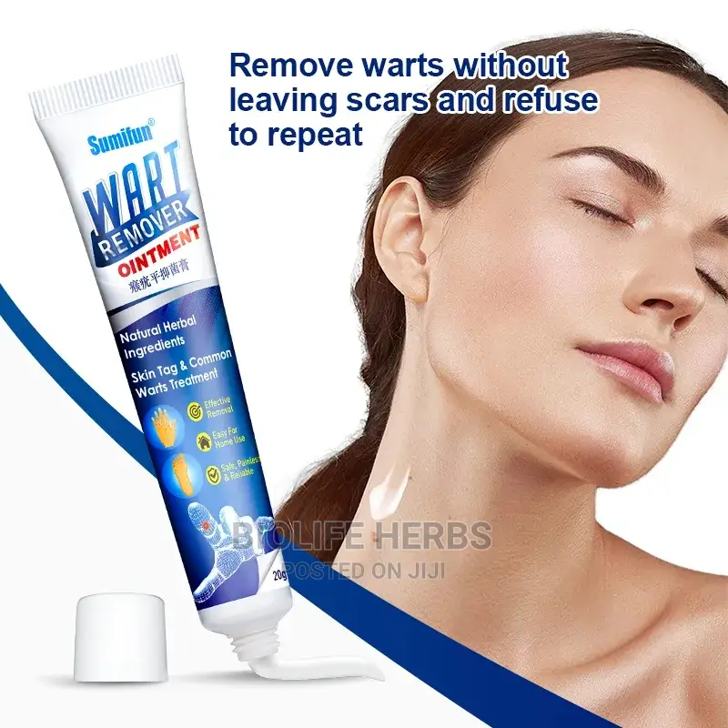 Warts Removal