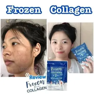 Frozen Collagen Whitening X10