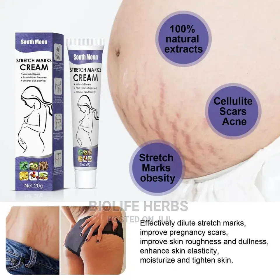Stretch Marks Cream