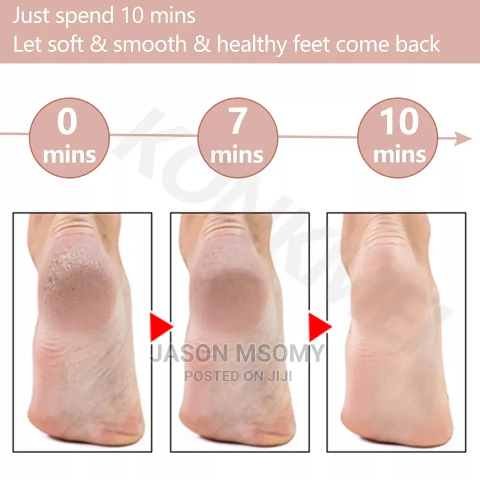 Electric Peeling Pedicure
