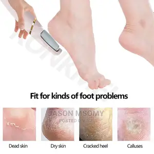 Electric Peeling Pedicure
