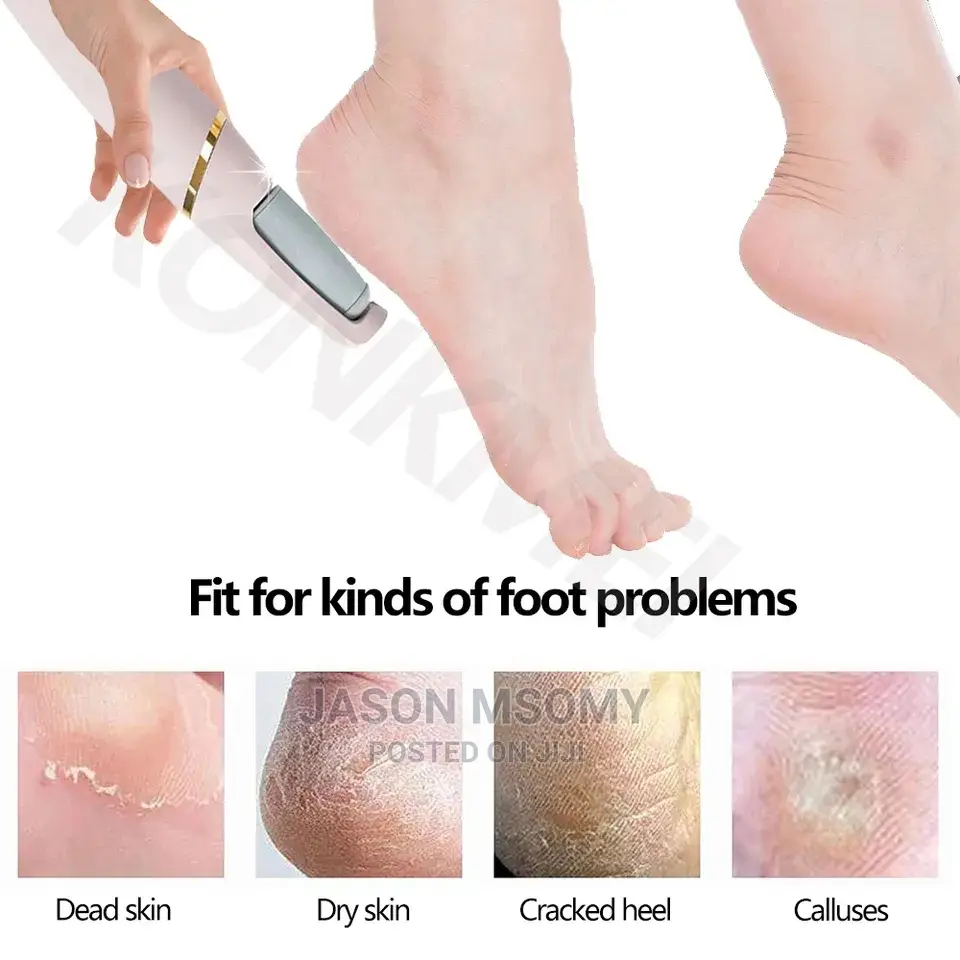 Electric Peeling Pedicure