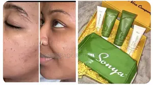 Usitumie Cream Kupendezesha Ngozi Yako.Use Sonya Pack