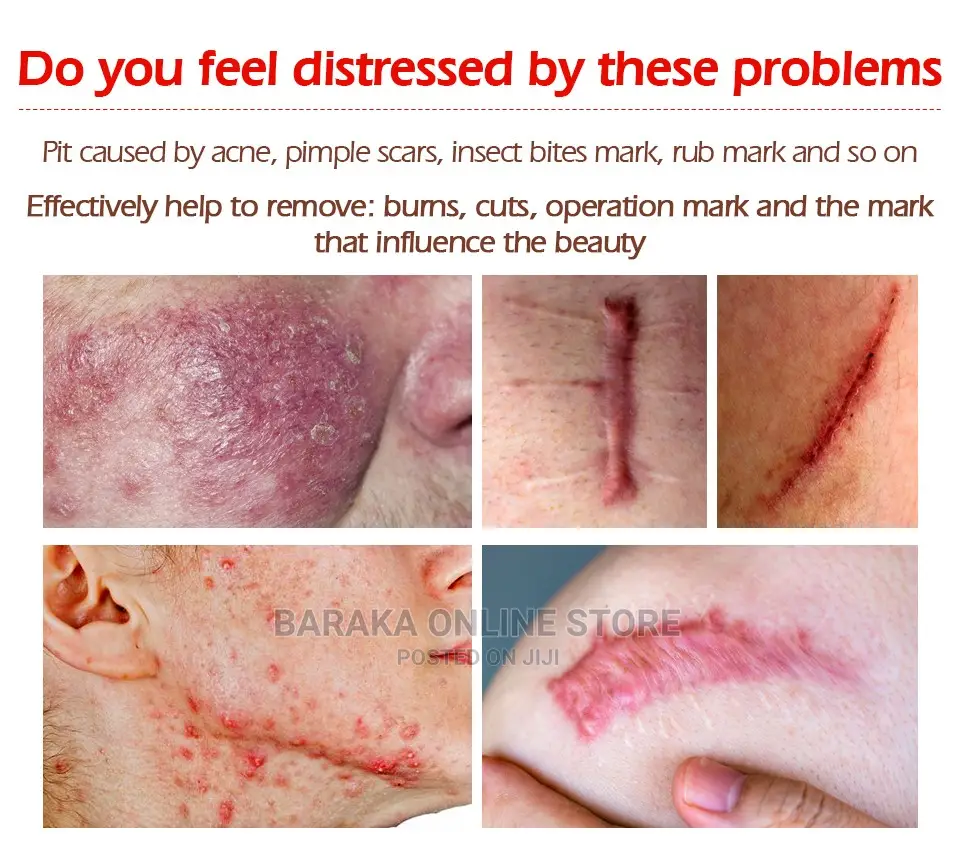 Repair Scar Gel Cream Treatment Vibrant