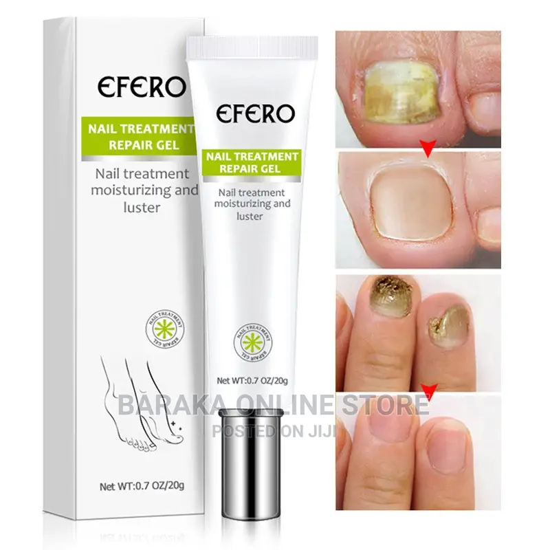 Nail Treatment Repair Gel Efero