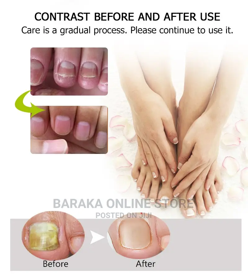 Nail Treatment Repair Gel Efero