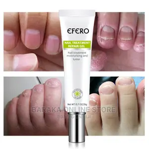 Nail Treatment Repair Gel Efero