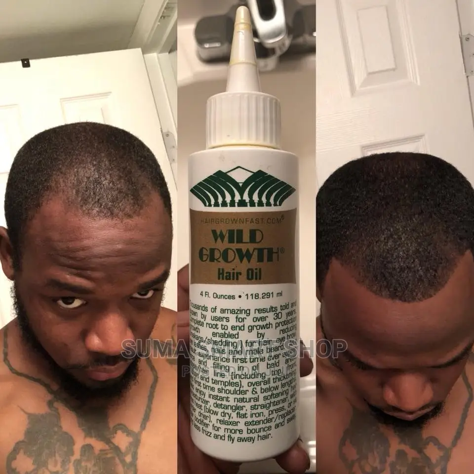 WILD GROWTH Hair Oil .