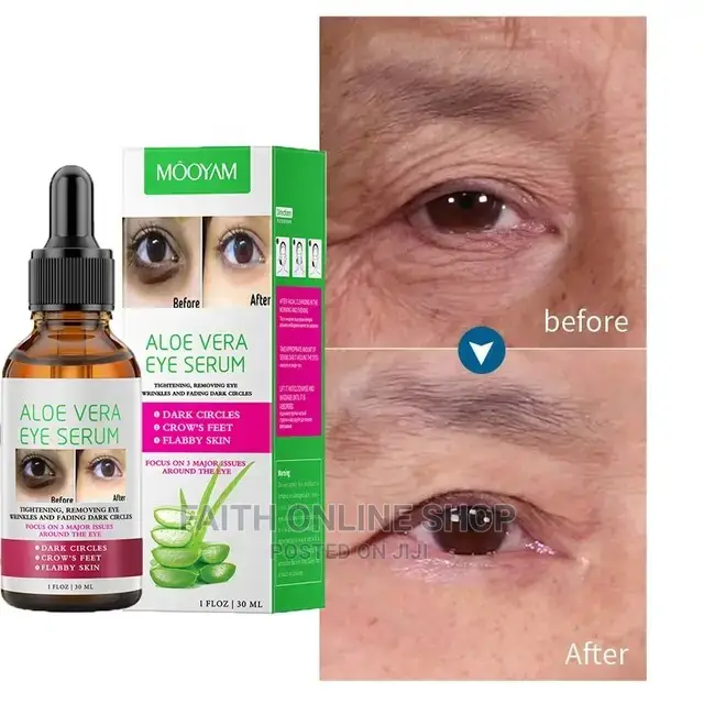Aloe Vera Eye Serum