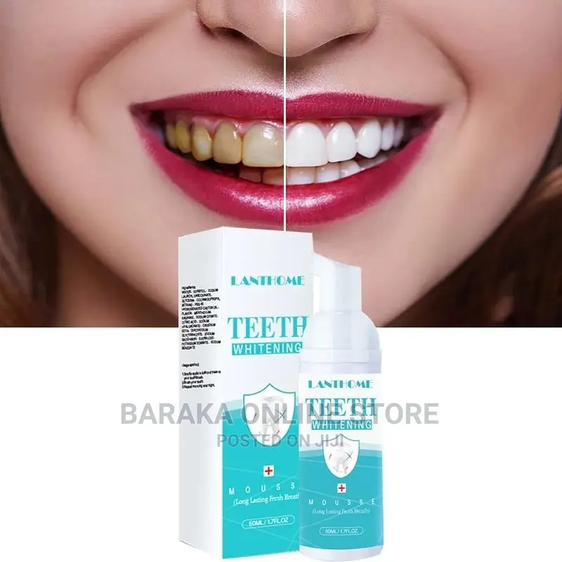 Teeth Whitening