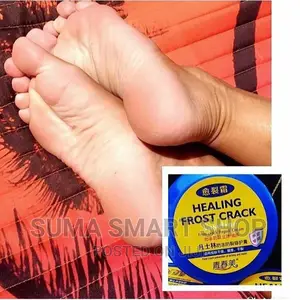 CRACKED Heel Repair Cream. (Ondoa Magaga )