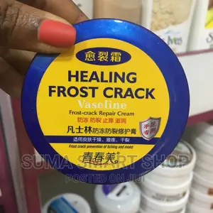 CRACKED Heel Repair Cream. (Ondoa Magaga )