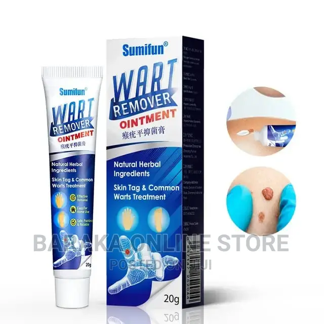 Wart Remover Cream