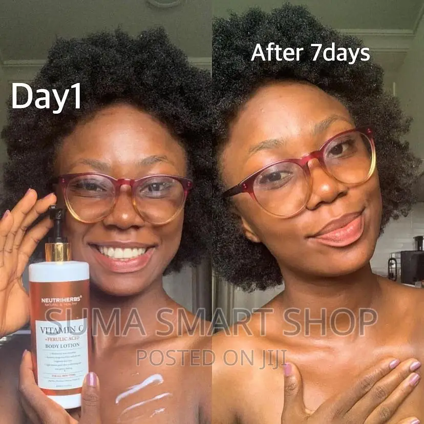 NEUTRIHERBS Vitamin C Lotion .