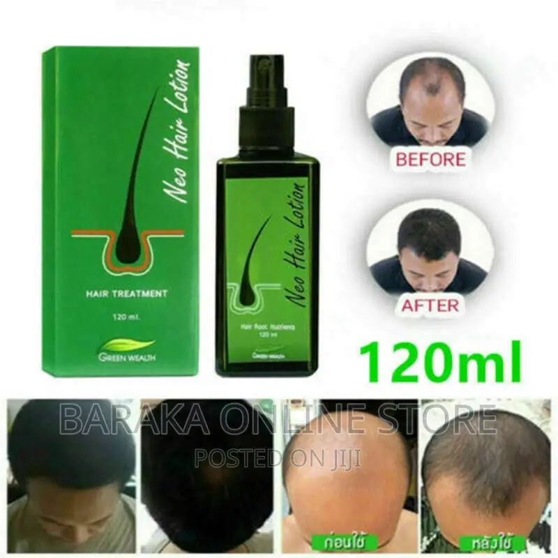 Neo Hair Lotion Treatment