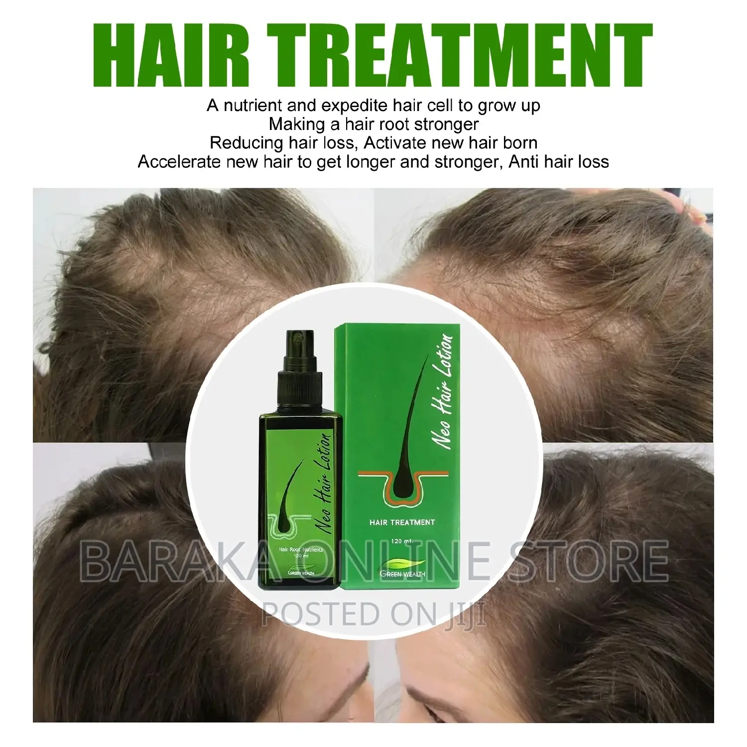 Neo Hair Lotion Treatment