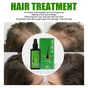 Neo Hair Lotion Treatment