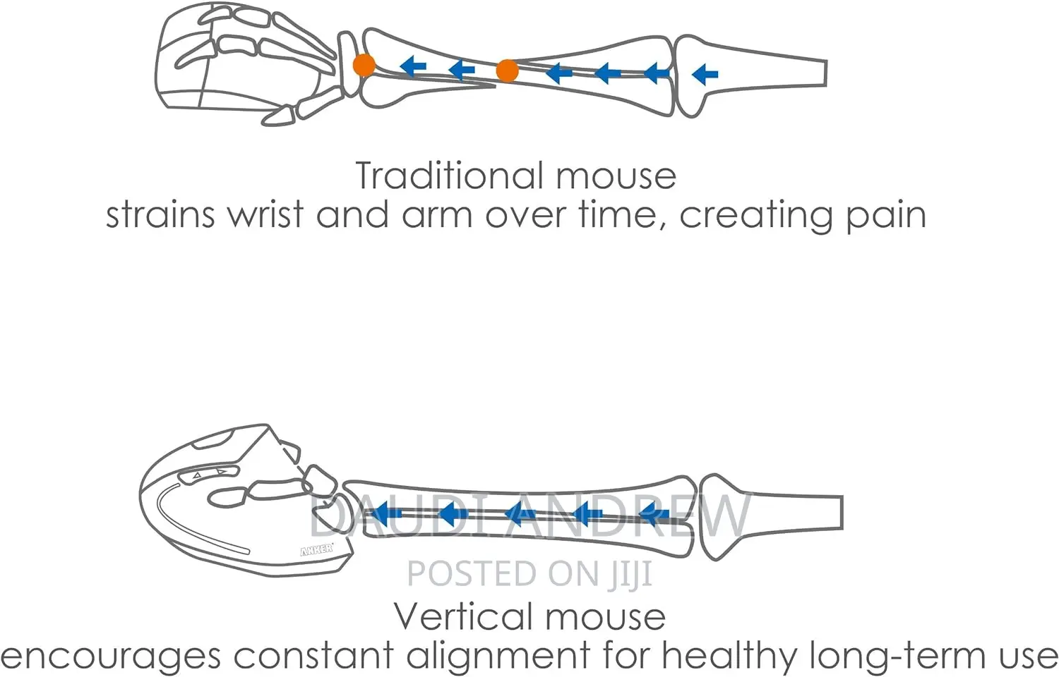 Anker Ergonomic Optical Usb Wired Vertical Mouse
