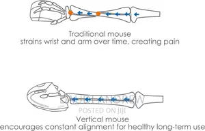Anker Ergonomic Optical Usb Wired Vertical Mouse