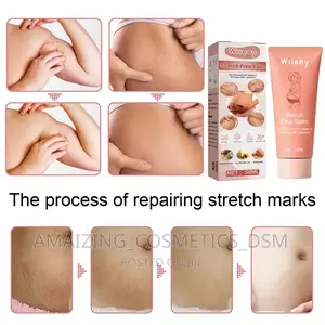 Strechmark Removal Cream